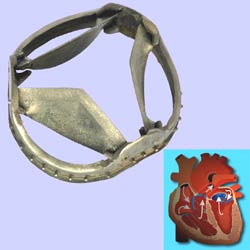 Artificial heart valve consisting of heart valve ring and three cusps.